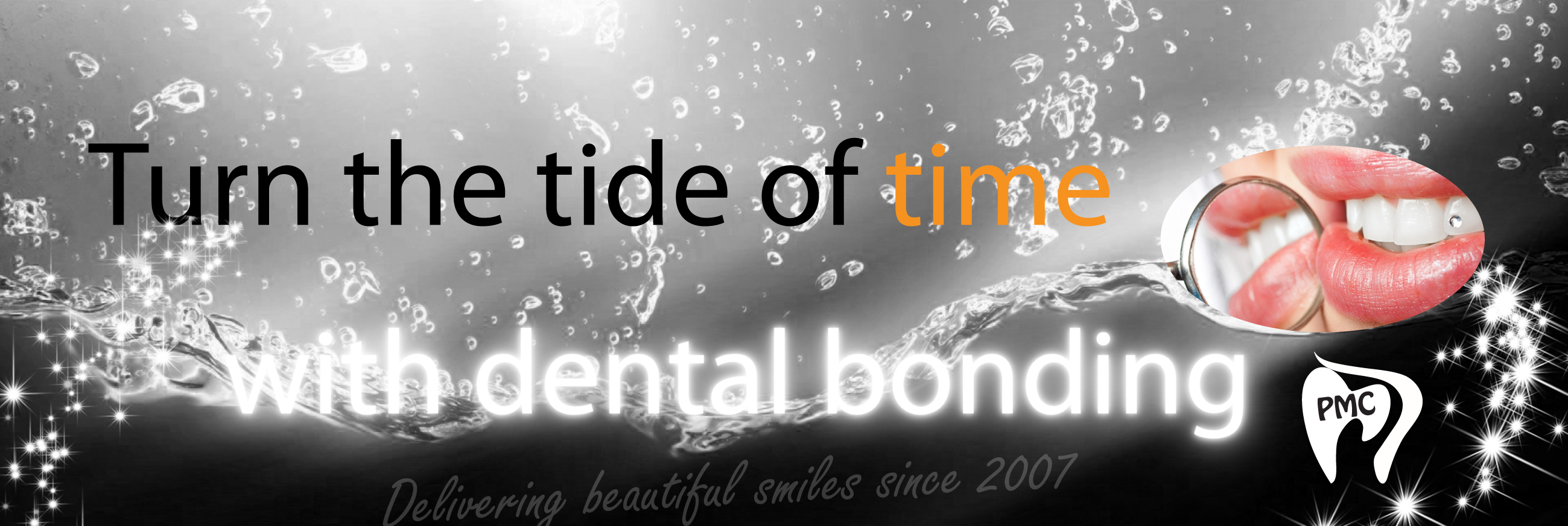 Dental bonding image