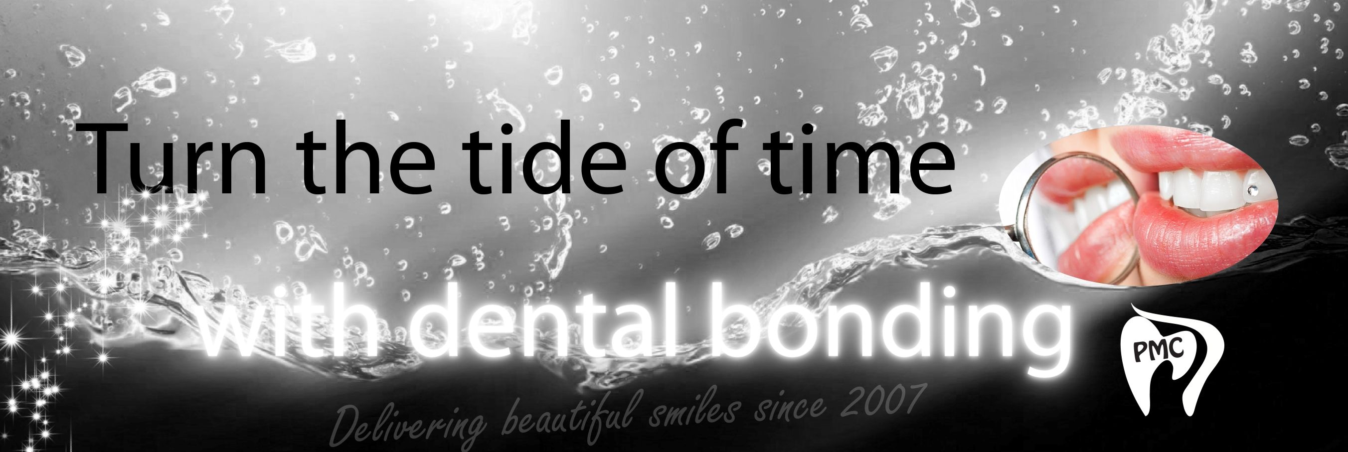 Dental bonding image